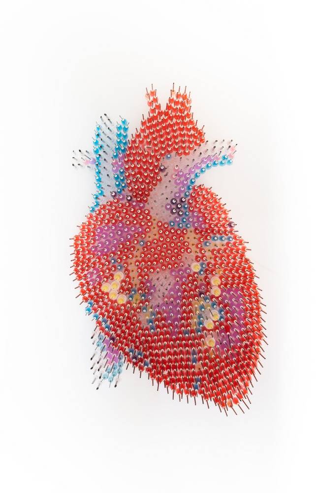 Ulrike Asamer, Cor, 2017, Medizinische Kanülen, Milchglas, Aluminiumrahmen, © Ulrike Asamer